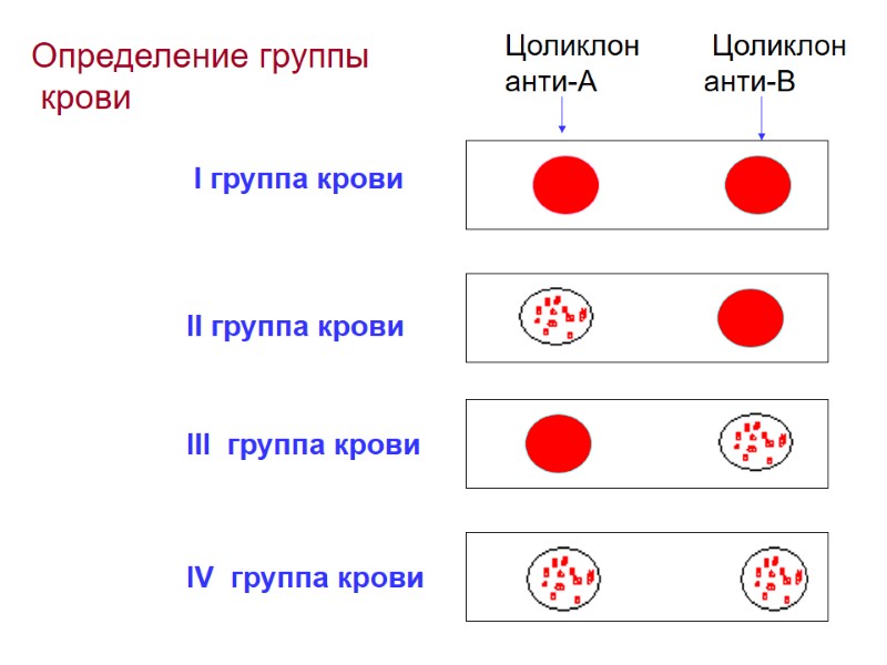 Цоликлон  анти-А  Цоликлон  анти-В I группа крови II группа крови III